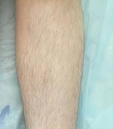 homeBeforeAfter