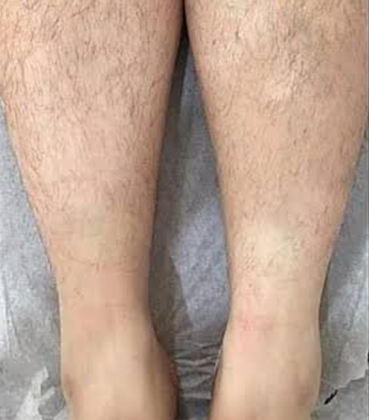 homeBeforeAfter